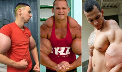 Synthol Freaks