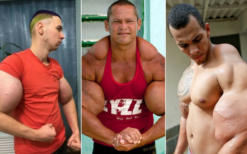 synthol side effects